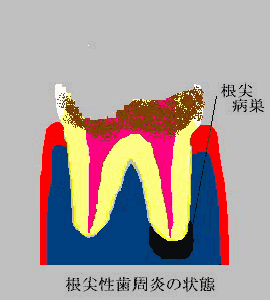 tooth per
